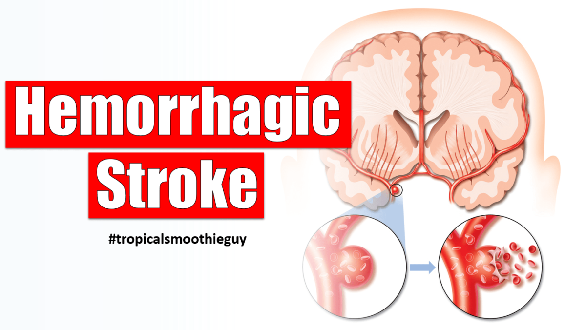 The Basics of Hemorrhagic Strokes